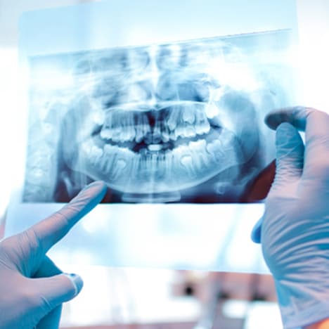 Digital X-Rays, Toothworks Dental Clinics